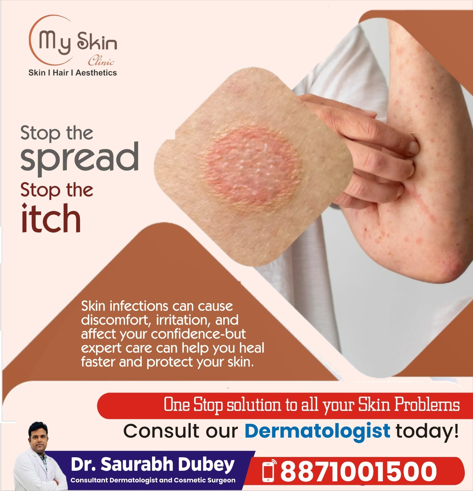 Skin Infection Treatment in Indore